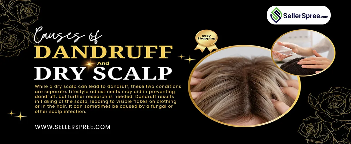 Cause of Dandruff Or Dry Scalp? SellerSpree